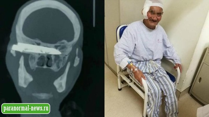 Мужчине вонзили в голову 10