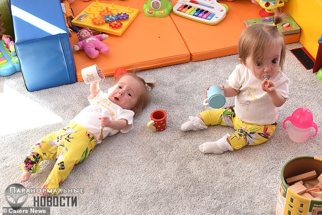 Чудом выжившие близнецы с крайне редкой и смертельно опасной «стеклянной» болезнью