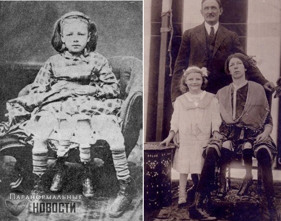 История четырехногой женщины Миртл Корбин