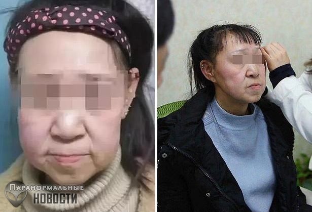 Врачи взялись помочь китайской девочке