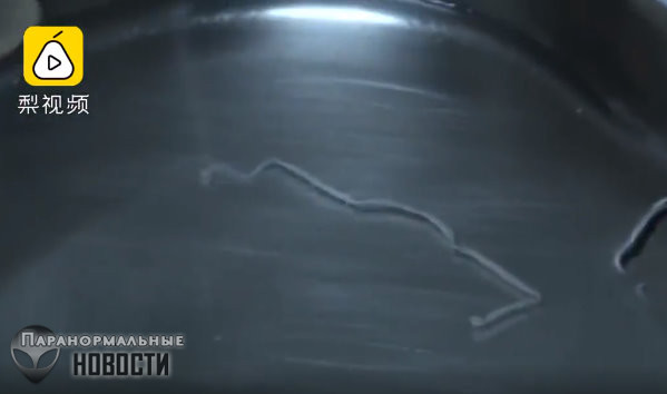В голове китайца 30 лет жил 10
