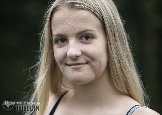 Хирург совершил чудо, оставив после сломанной и отсоединенной челюсти лишь несколько шрамов 